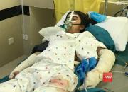 عکس/ زخمی‌های انفجار کابل در بیمارستان