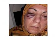 ماجرای ضرب و شتم زائر زن عراقی در فرودگاه مشهد