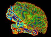 کشف غیرمنتظره علت پیشرفت آلزایمر در مغز