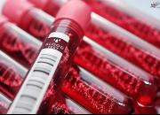 افزایش خطر مرگ زودهنگام با کاهش نوعی سلول خونی