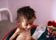 با پول پاتریوت چند کودک یمنی را می‌توان نجات داد؟