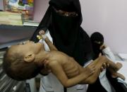 تازه‌ترین گزارش «صندوق نجات کودکان» درباره کودکان یمن