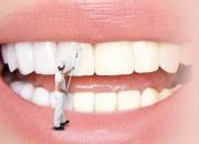 ۷ روش خانگی برای سفید کردن دندان